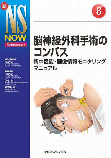 m3電子書籍 | 新NS NOW 17 脳動脈瘤 専門医になるための基本ポイント