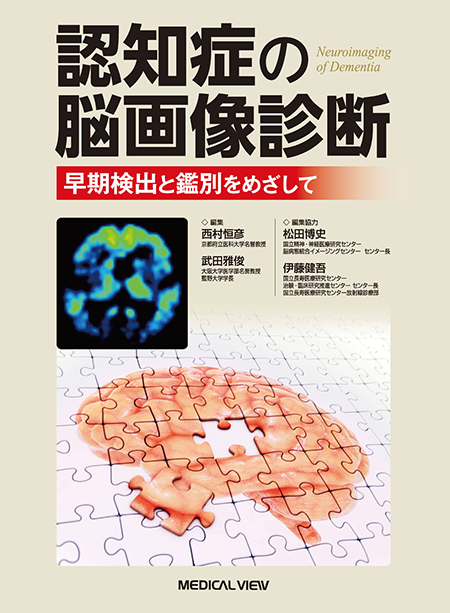 m3電子書籍 | 認知症の脳画像診断 早期検出と鑑別をめざして