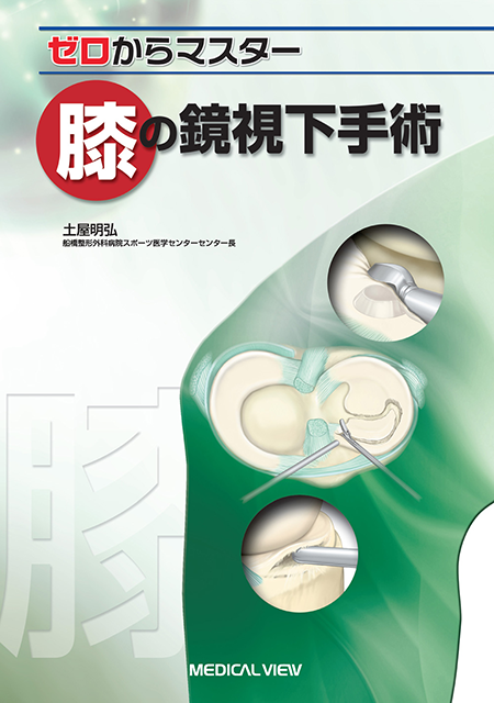 m3電子書籍 | ゼロからマスター 肩の鏡視下手術 改訂第2版