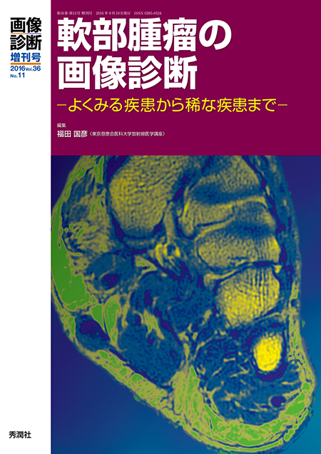 m3電子書籍 | 画像診断 2016年臨時増刊号 （Vol.36 No.11） 軟部腫瘤の