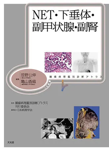 m3電子書籍 | 腫瘍病理鑑別診断アトラス 大腸癌 第2版