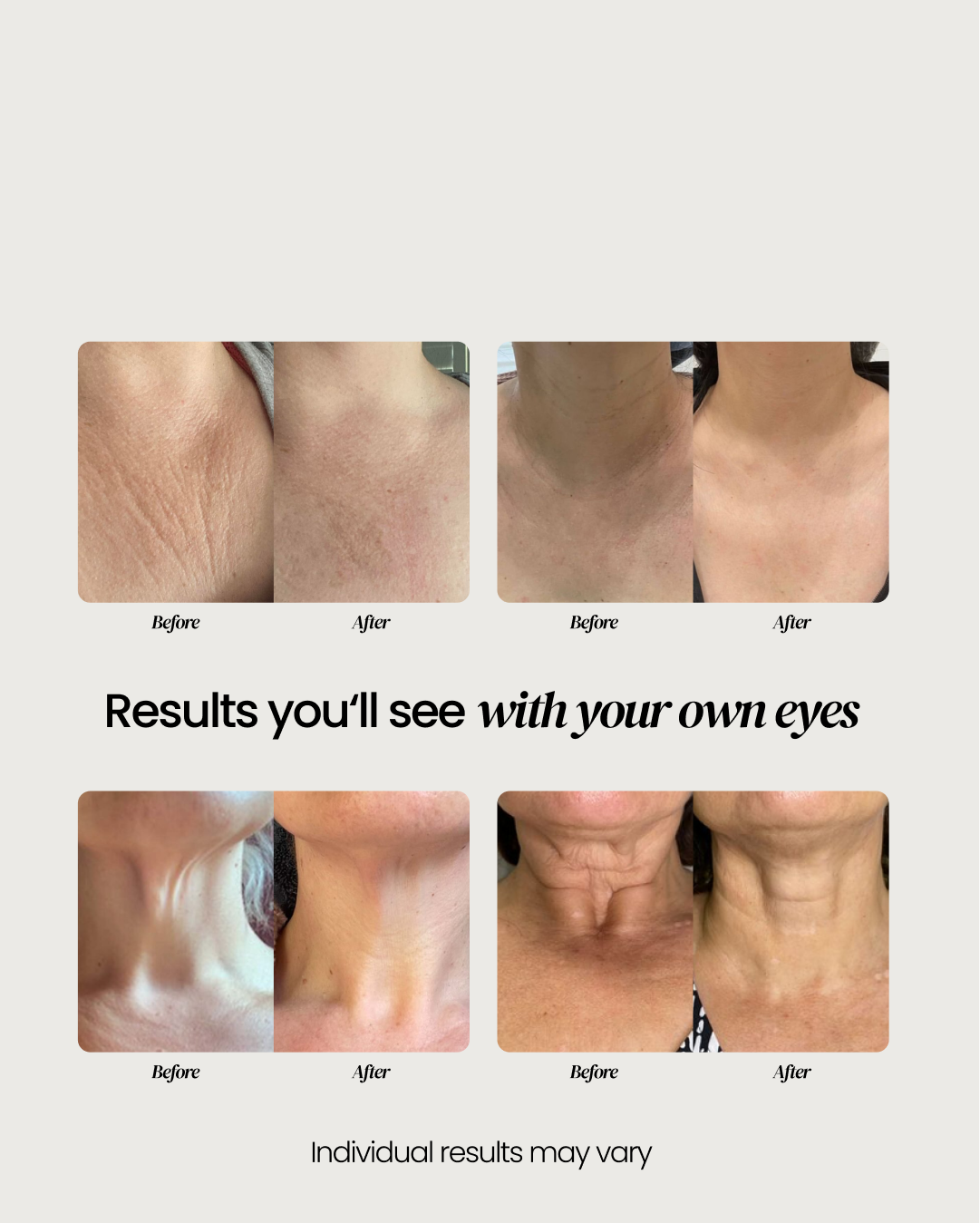 Neck Firming Cream - Visibly Lifts & Firms | Eliré Korean Skincare