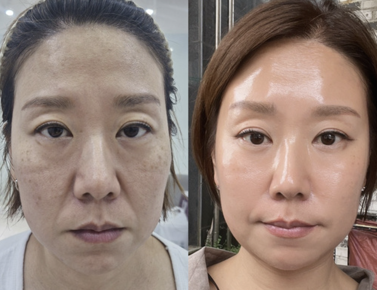 インセルダム（ICD）とは？韓国発の肌再生型ダーマコスメ｜特徴・効果