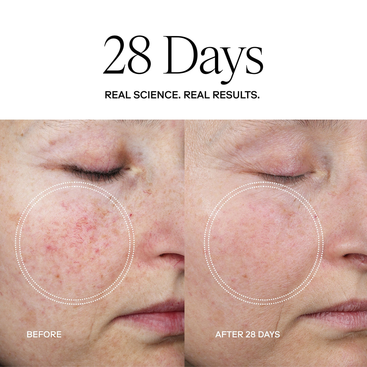 EXO PLUS® Anti-Aging Cream With Exosomes & Peptides - Exoceuticals