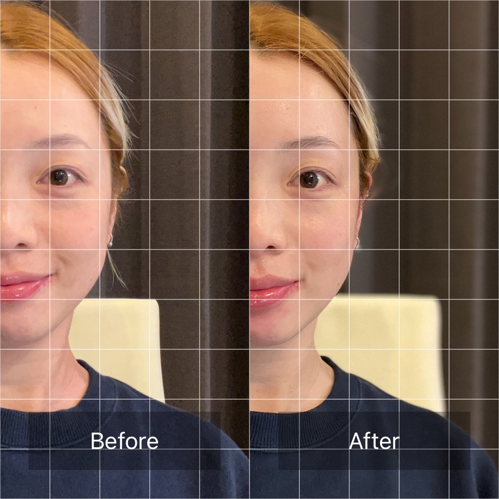 yukino made×FinalA】W最新美顔器で小顔も美肌もパーフェクト