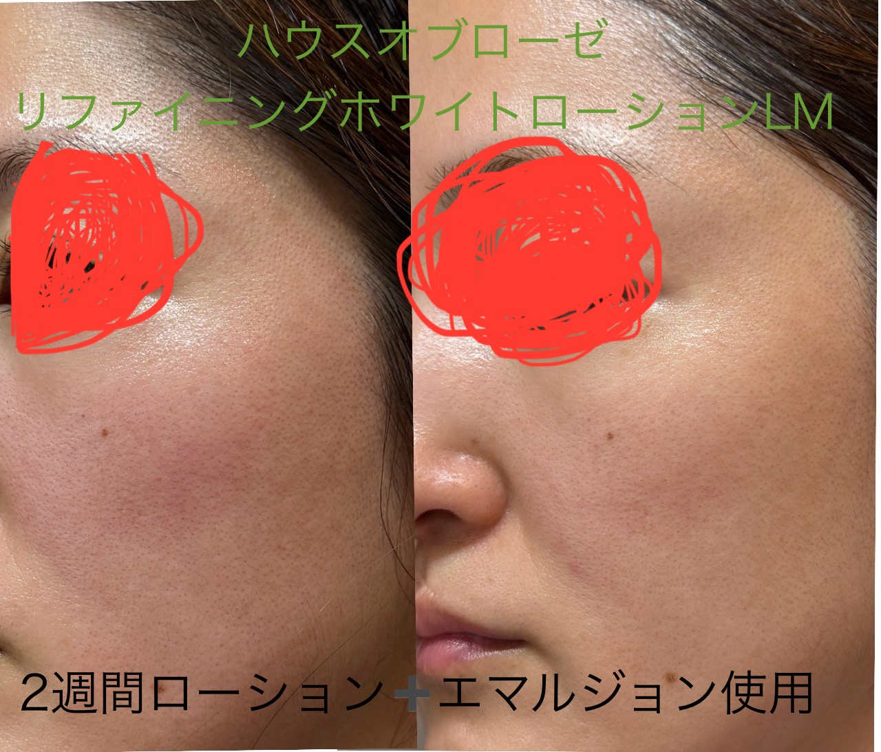 ハウス オブ ローゼ / リファイニングホワイト ローションLMの公式商品