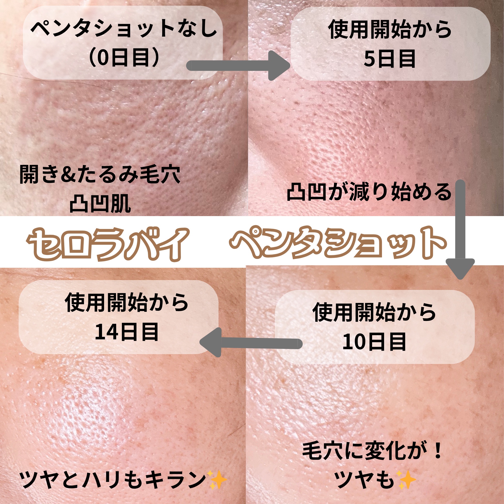 CELORABY / ポテンション・ペンタショットの口コミ（by agatha1126さん