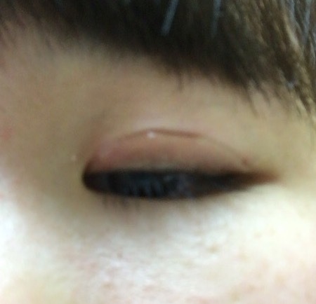 StreeTrend / ナイトアイボーテの口コミ一覧（10代）｜美容・化粧品