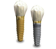 日本『京セラ（KYOCERA）』インプラント | 埼玉県狭山市 インプラント