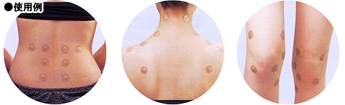 貼付型接触針 ゲルマ・イオネットのご紹介