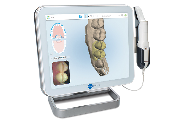 口腔内スキャナー「iTero」 - 豊中駅徒歩0分の歯医者、藤田歯科 豊中