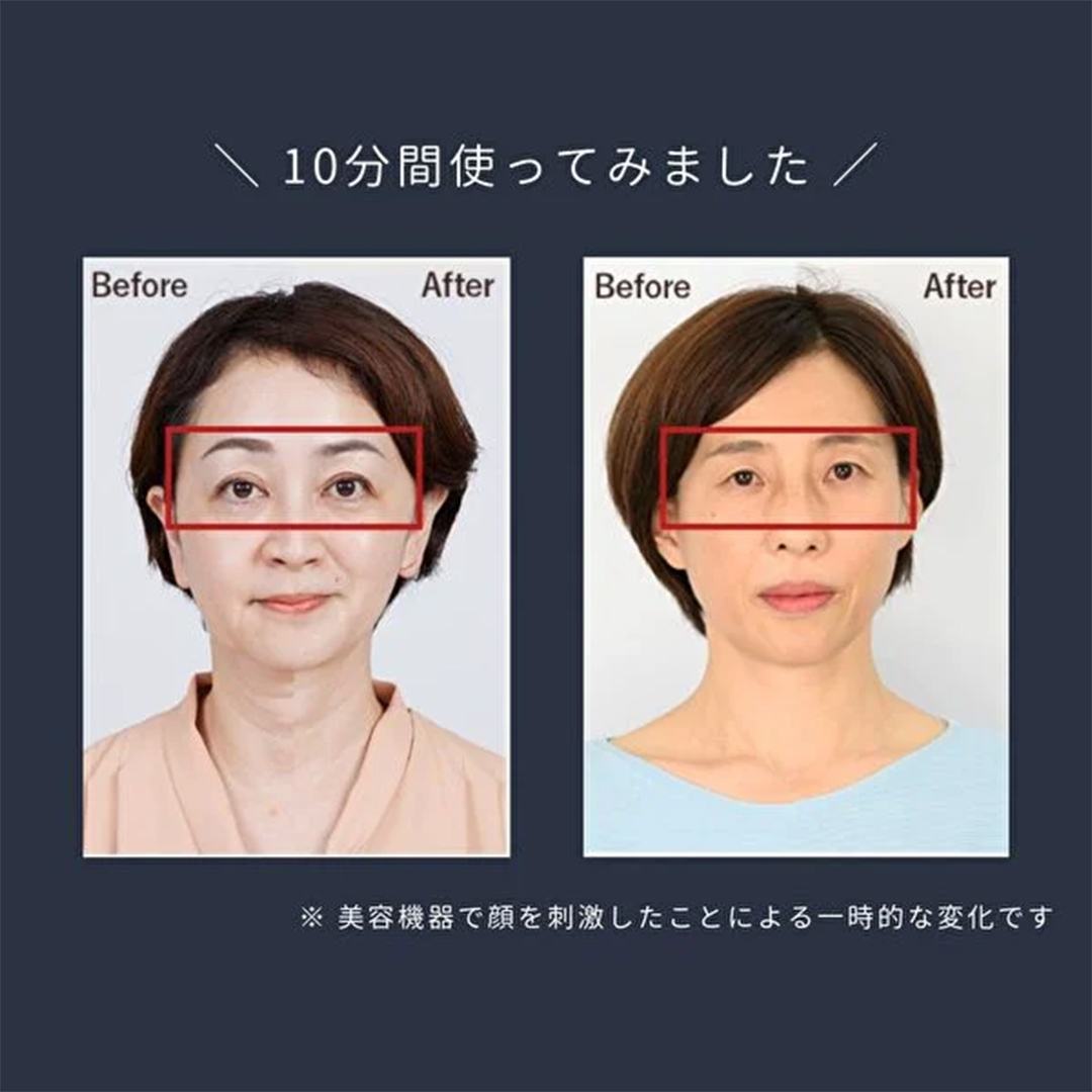 デザインリフト 目元ケアセット （ 本体＆目元用ストレッチフィット