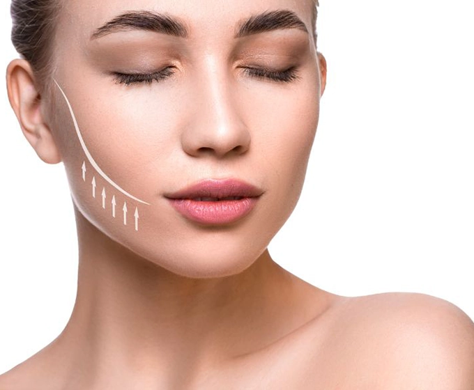 スレッドリフト（糸リフト） | 婦人科形成は東京都中央区の銀座あゆみ