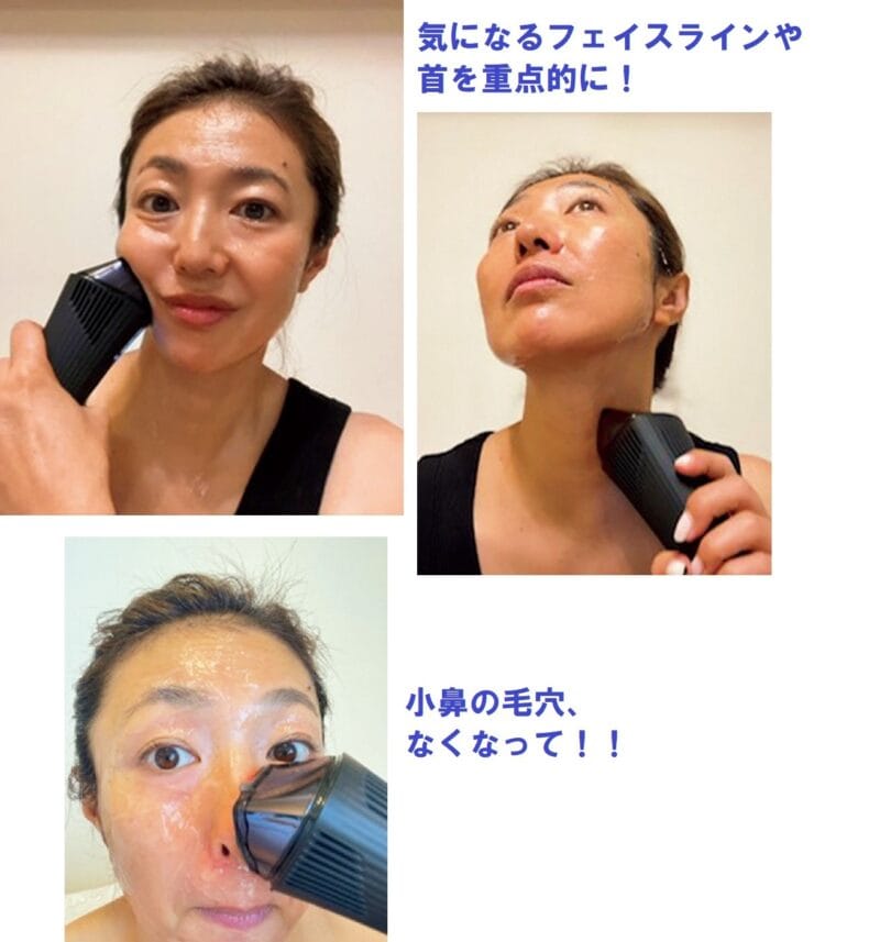40代美容【ファンデ薄塗りでもキレイ】大人気の美顔器［ReFa ダーマ
