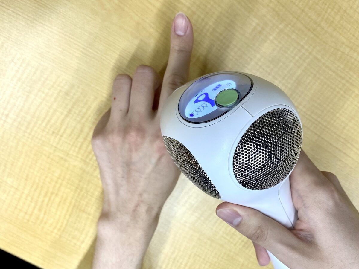 自宅で簡単「トリア脱毛器」実際に脱毛器を使ってリアルレビュー