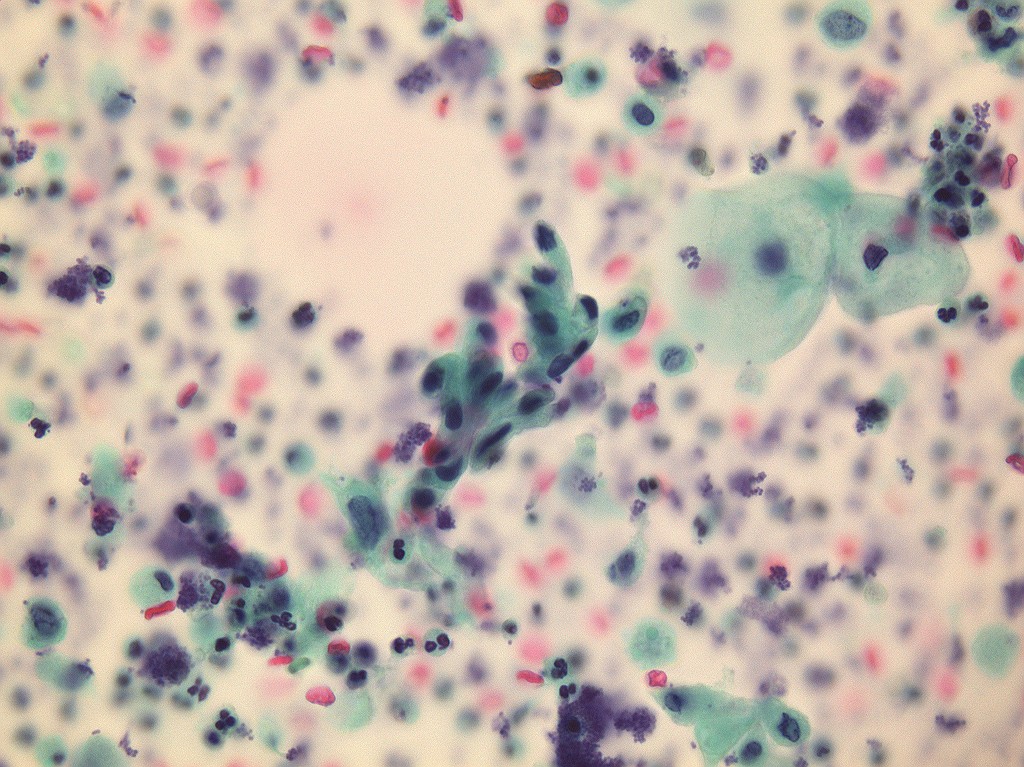 尿細胞診別府カンファレンス in 唐津