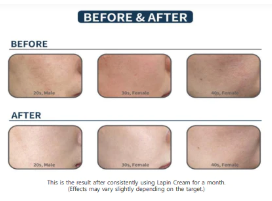 La ChomB] LAFIN COMPLETE RENEW CREAM, Regeneration Cream 35ml, K