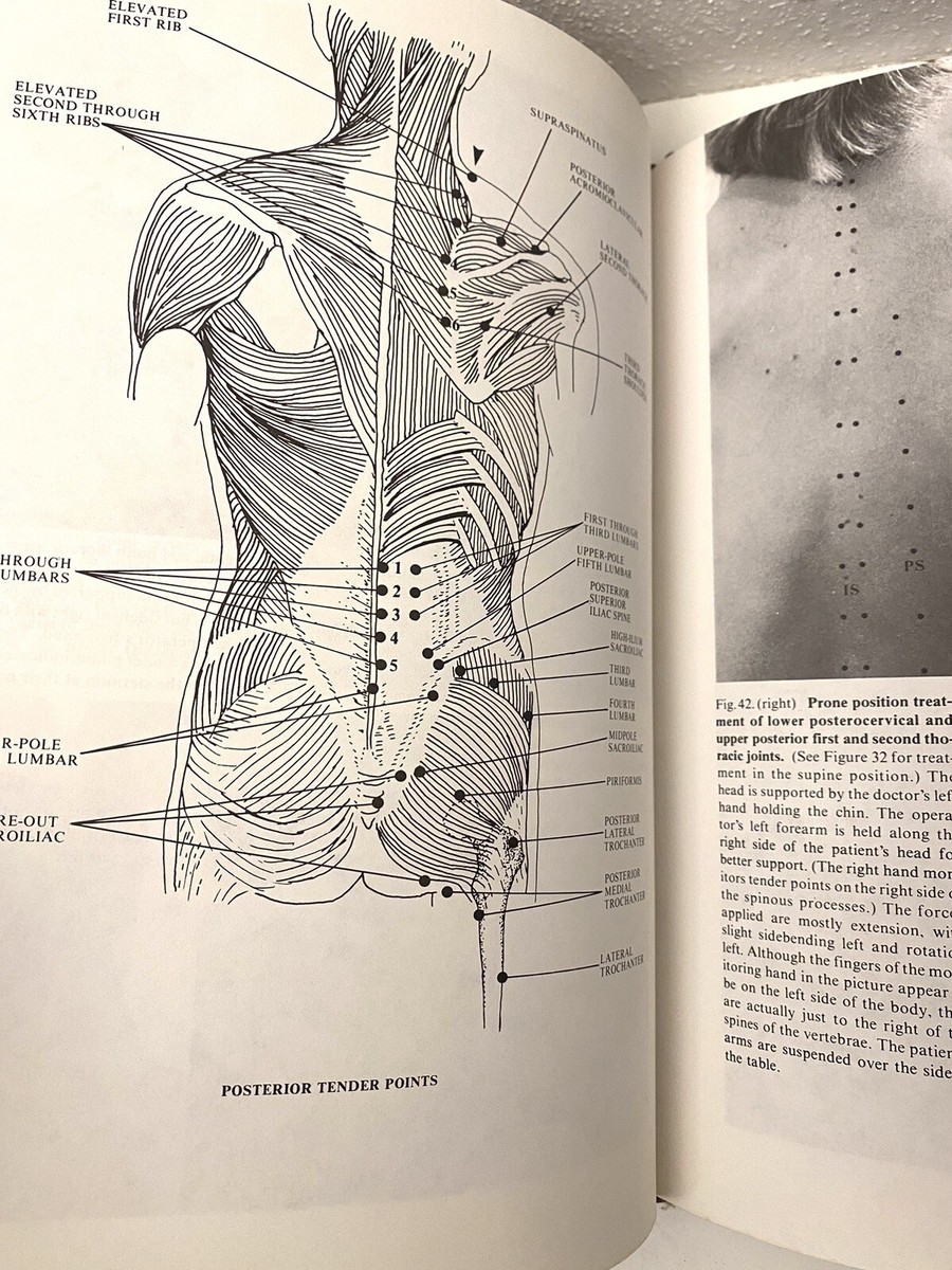 Dr.ジョーンズのストレイン-カウンターストレイン Dr.ジョーンズの