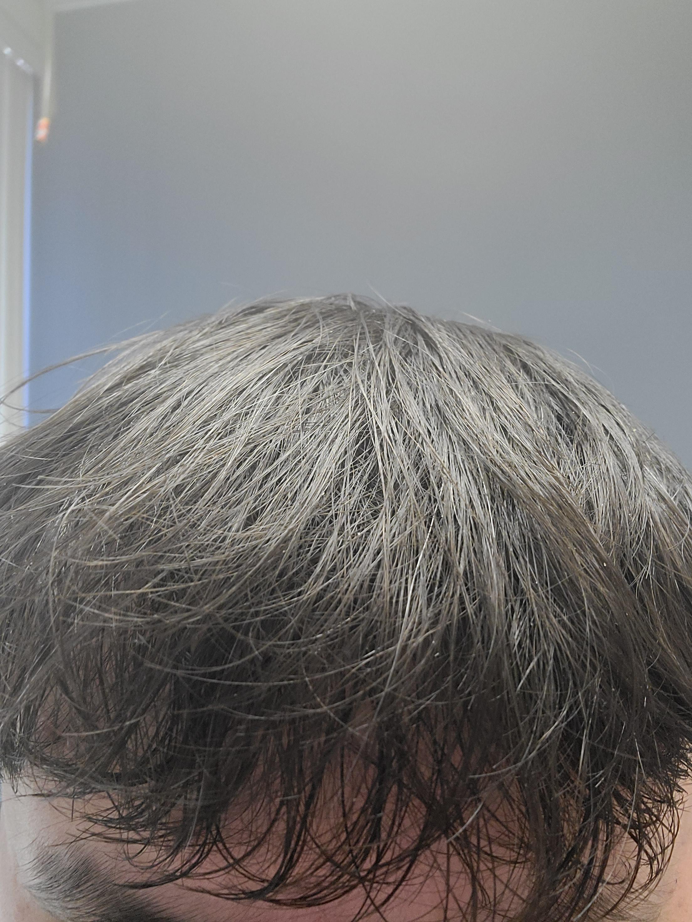Is my hair damaged : r/malehairadvice