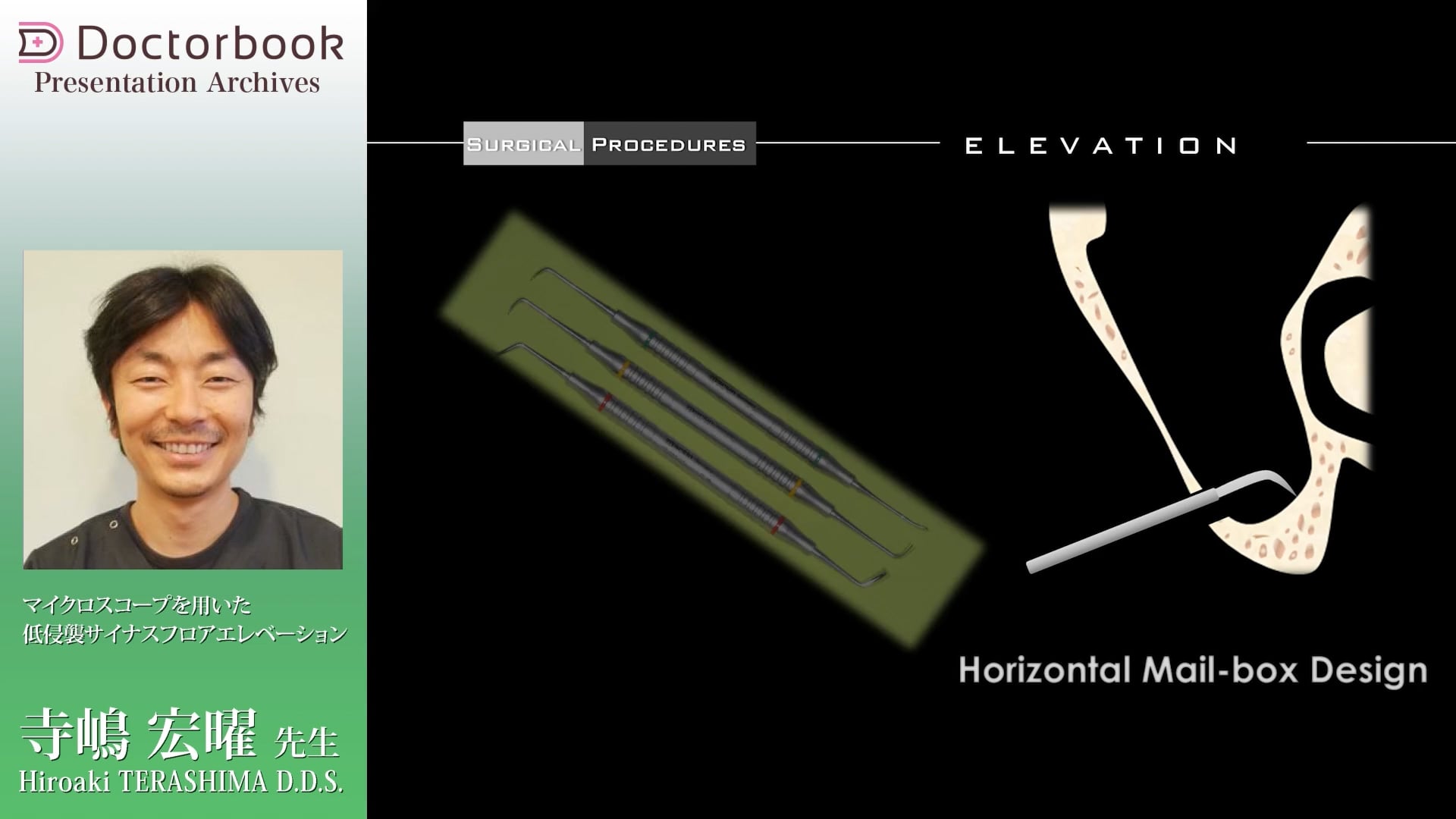 サイナスリフト | Doctorbook academy (ドクターブックアカデミー)