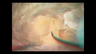 中耳・側頭骨3D解剖マニュアル[DVD-ROM付] | 書籍詳細 | 書籍 | 医学書院