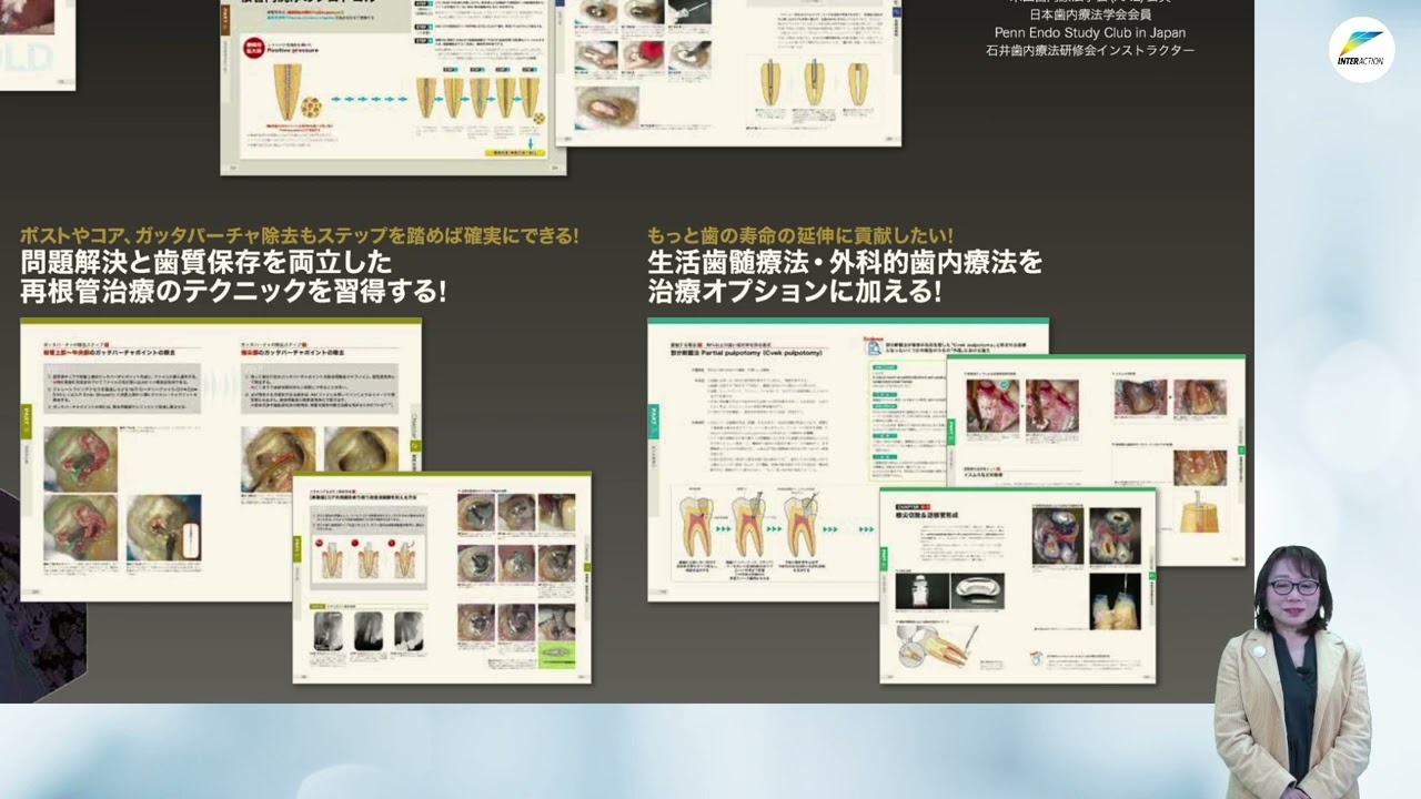 伊藤創平先生執筆『ビジュアル歯内療法学 生物学的コンセプトと