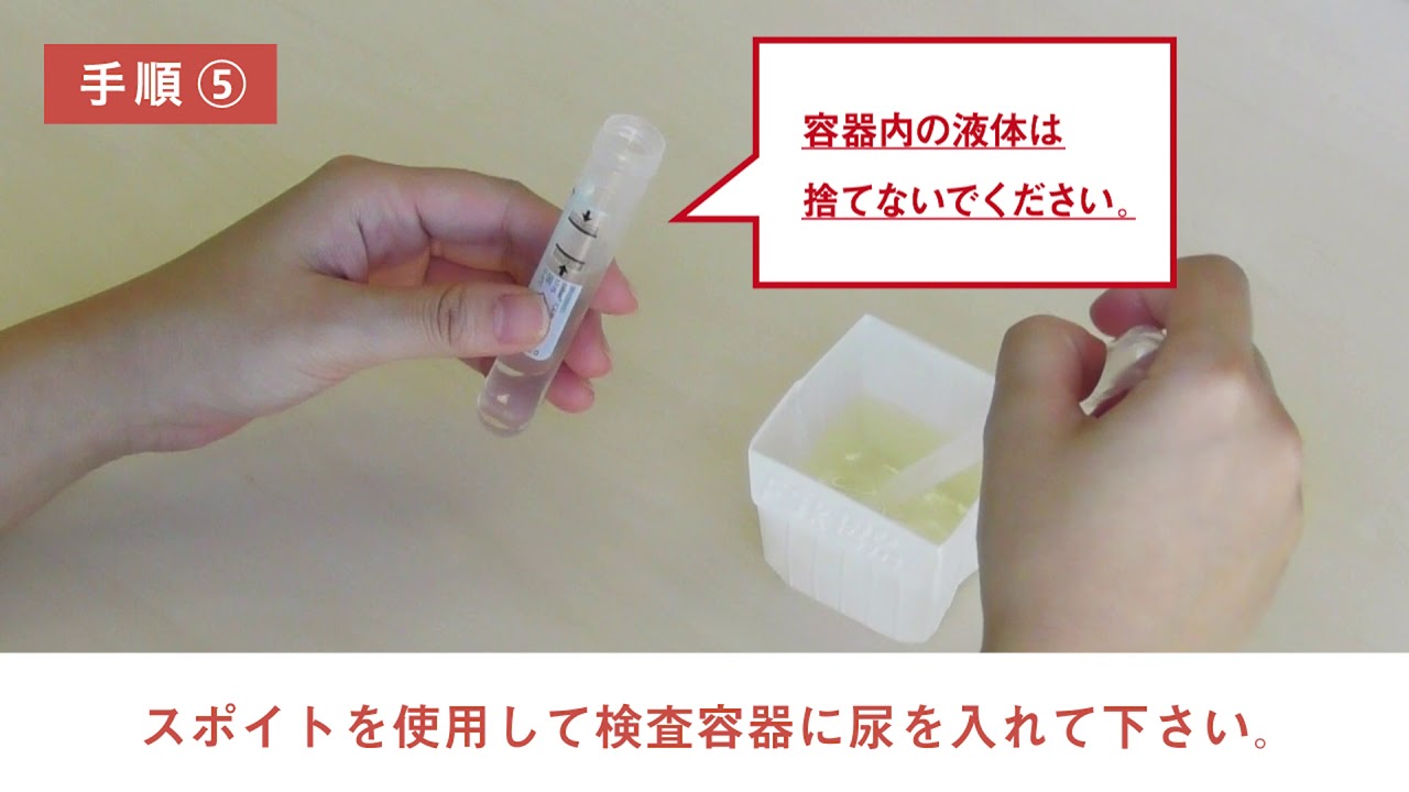 乱用薬物スクリーニング検査 | 性感染症（STD）・性病検査の予防会