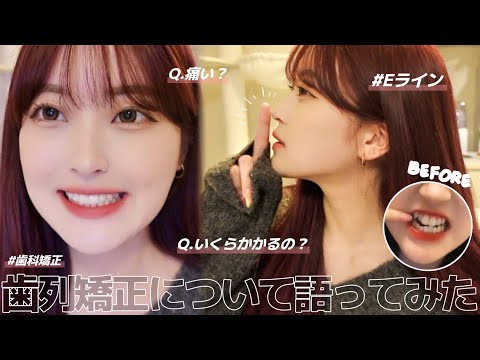 Orthodontics] I'll tell you everything about my orthodontics! Is