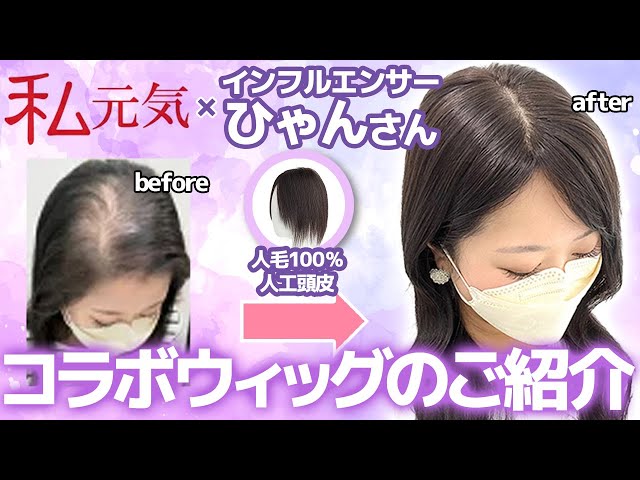 Introducing the partial wig [Igenki x Hyangsan collaboration