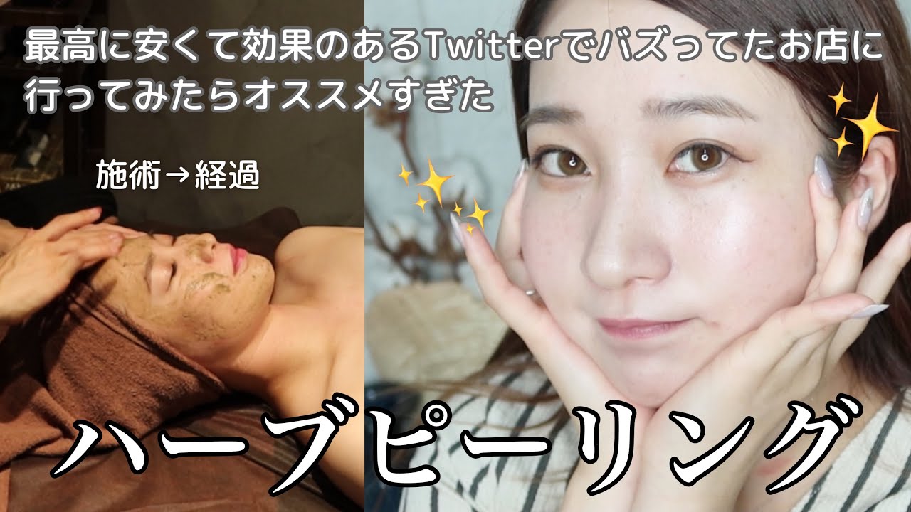 1週間経過】Twitterでバズってたお店のハーブピーリング受けてみた