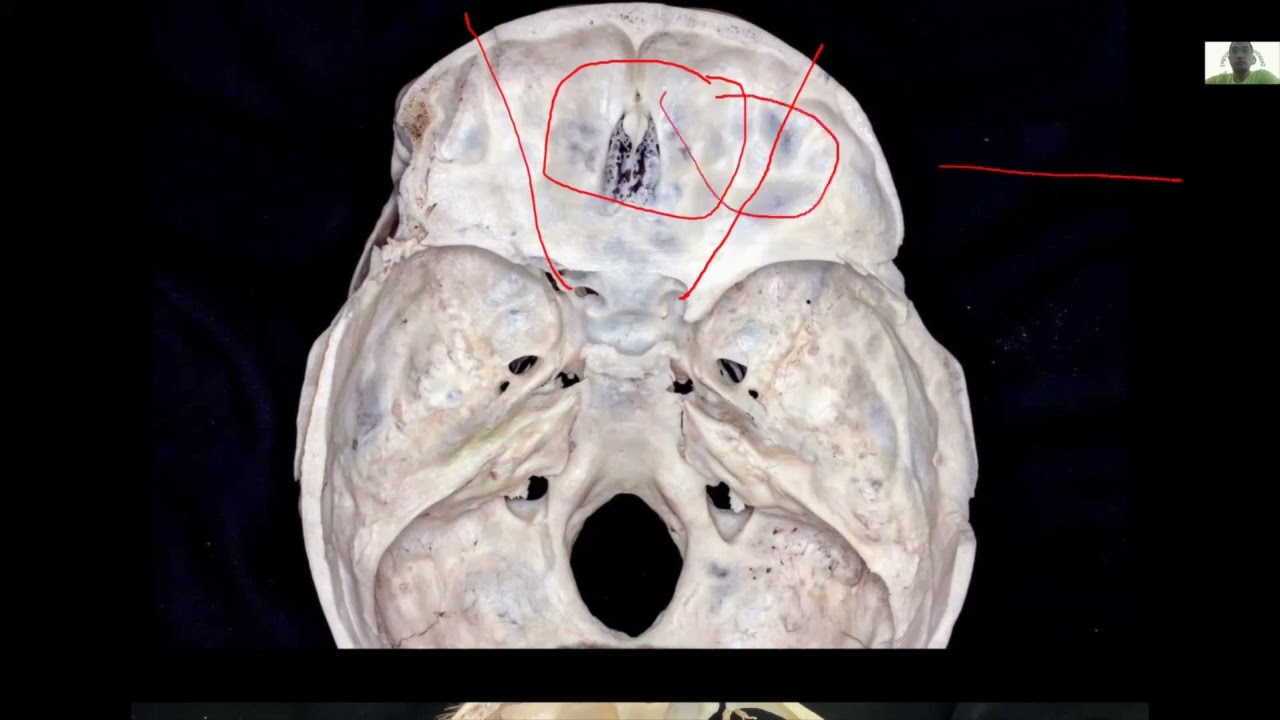 maxresdefault.jpg?sqp=-