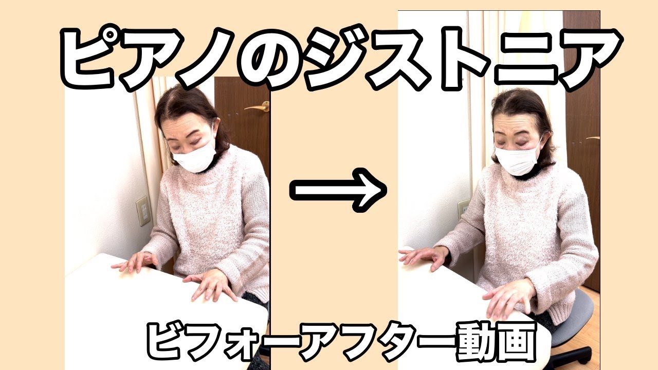 ピアノのフォーカルジストニア改善ビフォーアフター動画 | 石井克昇