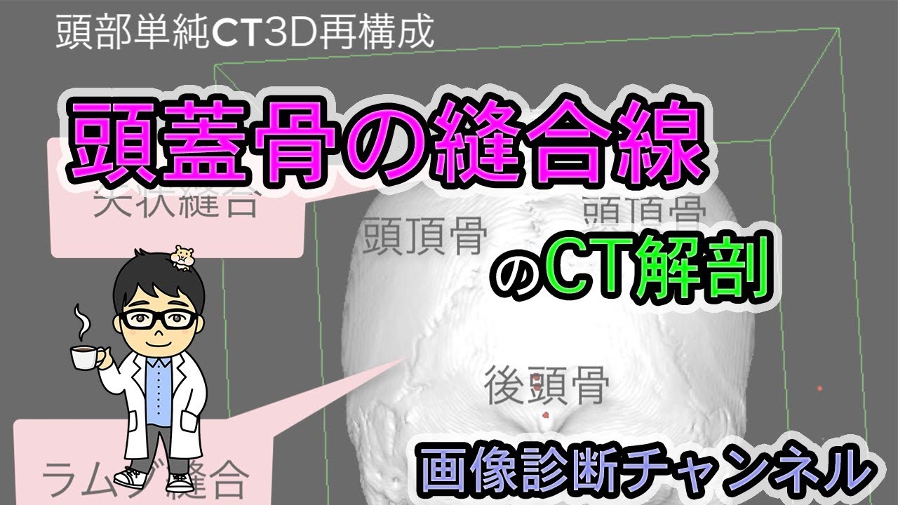 頭蓋骨の縫合線をCT画像で確認 - YouTube