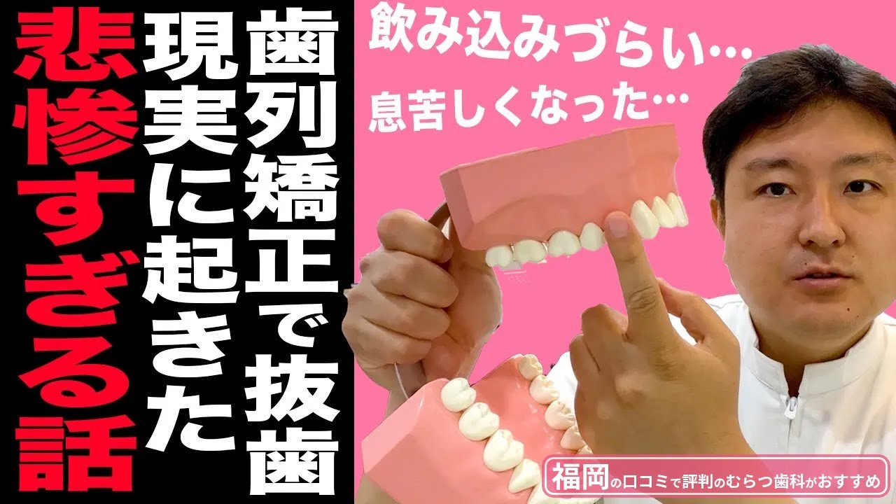 Please share※ I will tell you about a tragic orthodontic treatment
