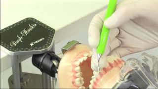 SRP実習用顎模型 [P15FE-MINT.1]｜株式会社ニッシン｜歯科模型・歯科