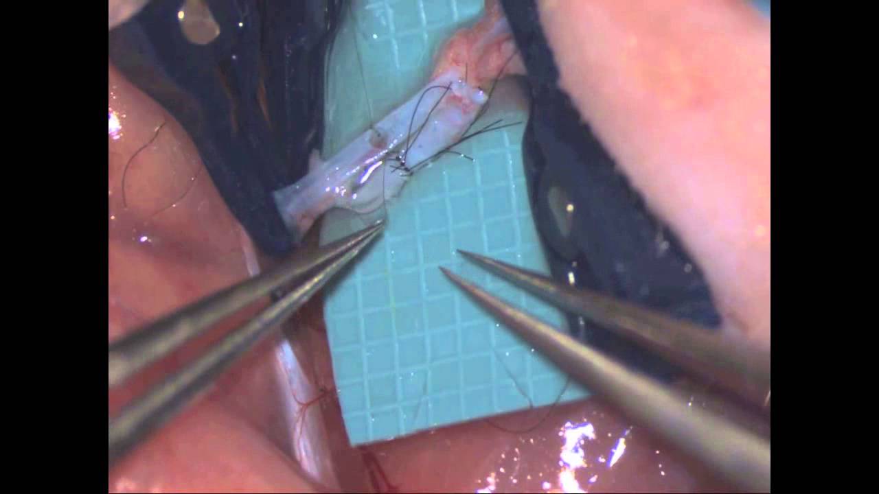 岡山大学形成外科 マイクロサージャリートレーニング15 ラット皮弁