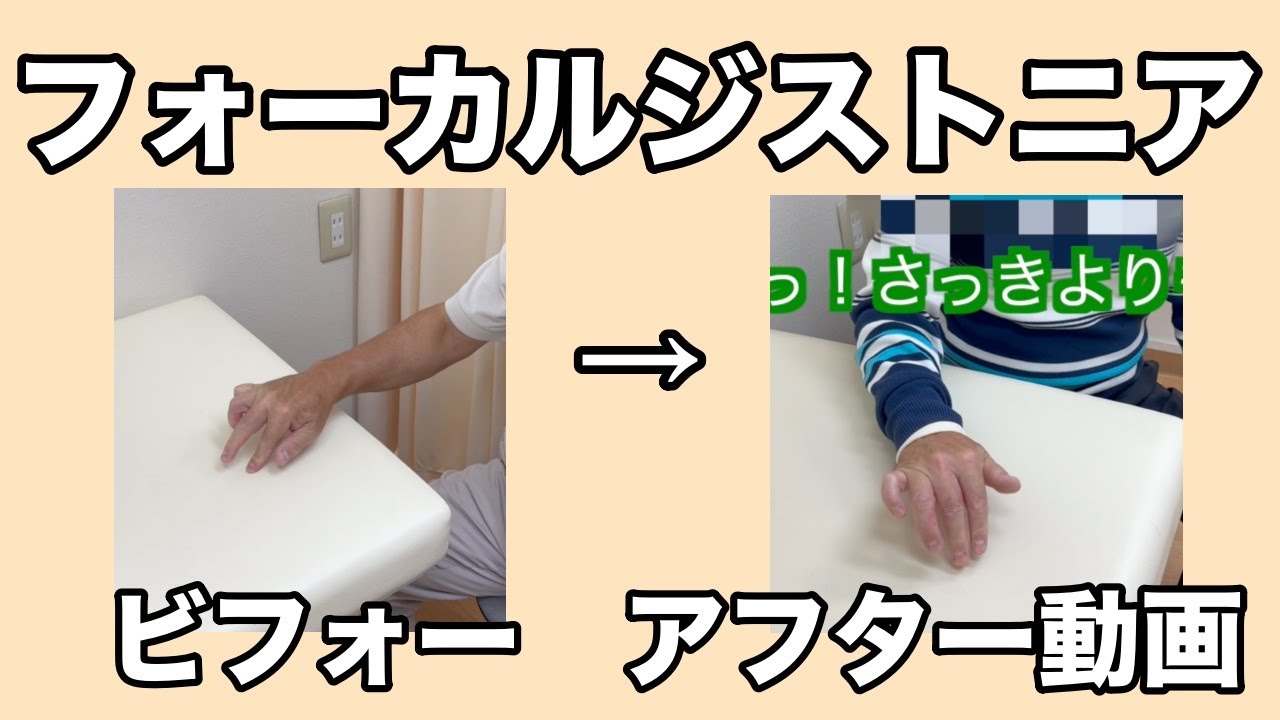 フォーカルジストニア(ピアノ)の施術ビフォーアフター動画 | 石井克昇