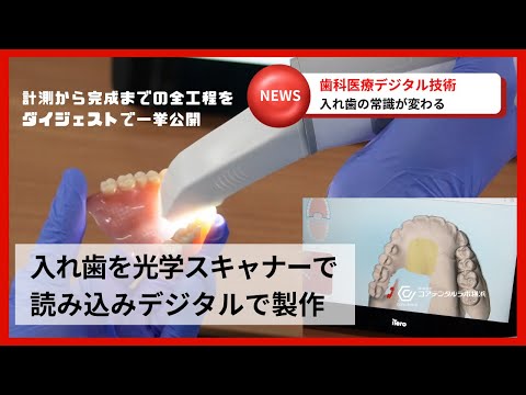 IOS口腔内スキャナー×3Dプリンターで入れ歯をデジタル複製！最新技術の