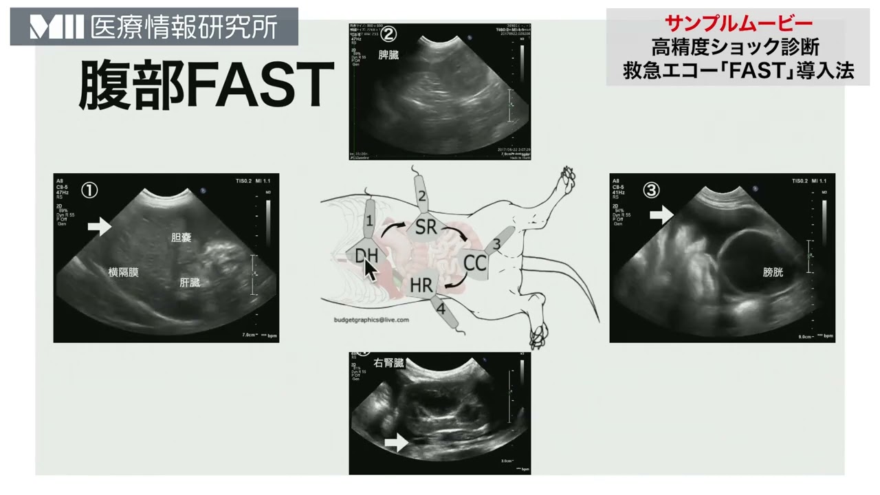 高精度ショック診断救急エコー「FAST」導入法 | 株式会社 医療情報研究所