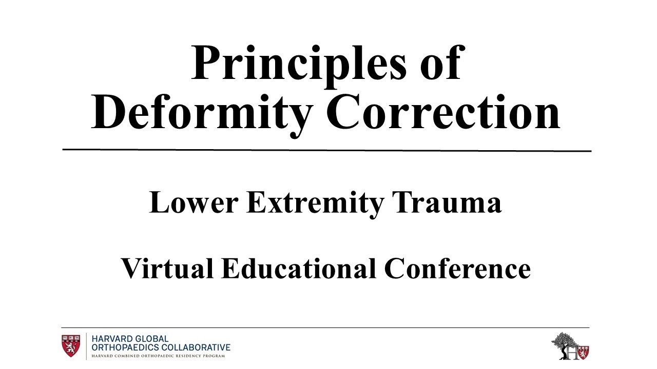 Principles of Deformity Correction - YouTube