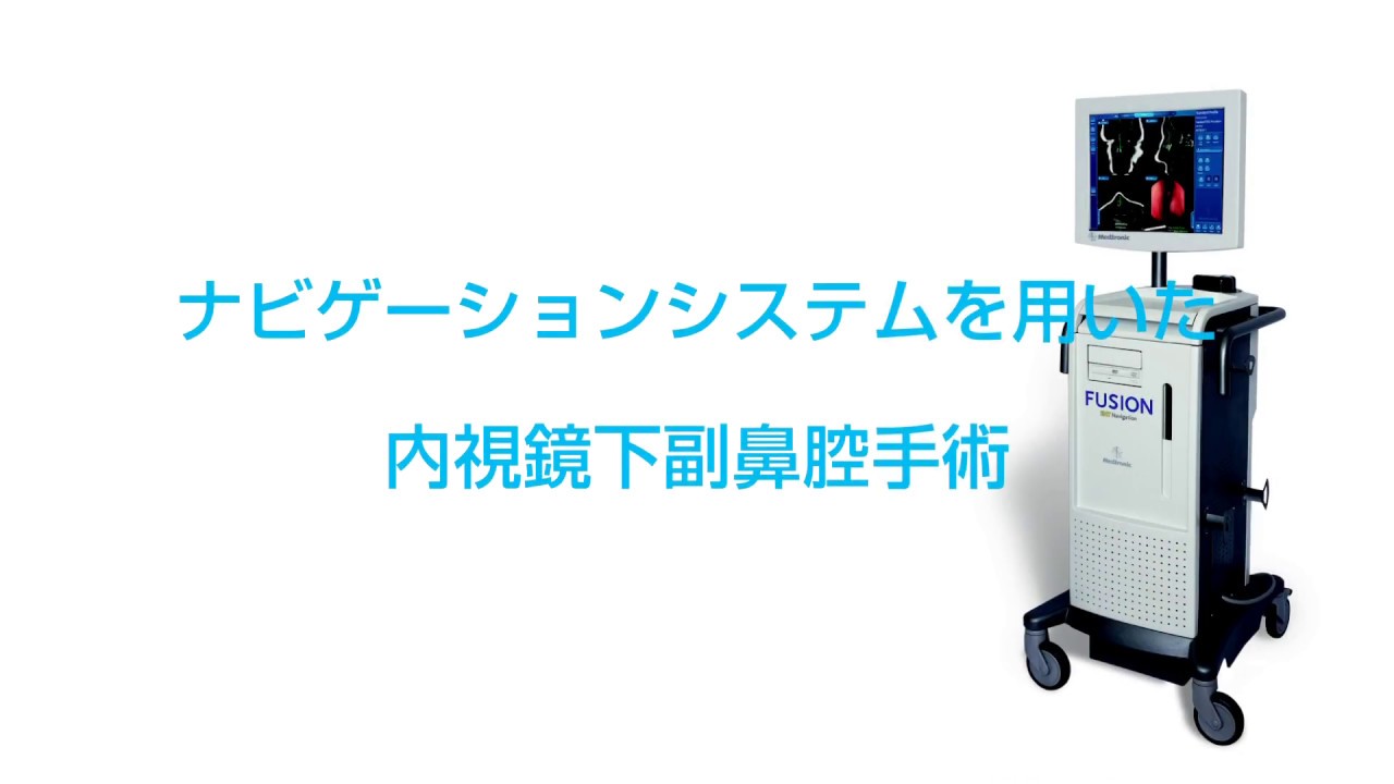 内視鏡下副鼻腔手術 副鼻腔の壁を一部取り払って空気や鼻汁の流れを