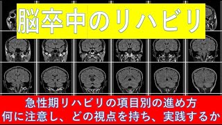 脳卒中急性期での項目別リハビリテーションの進め方-何に注意し、どの