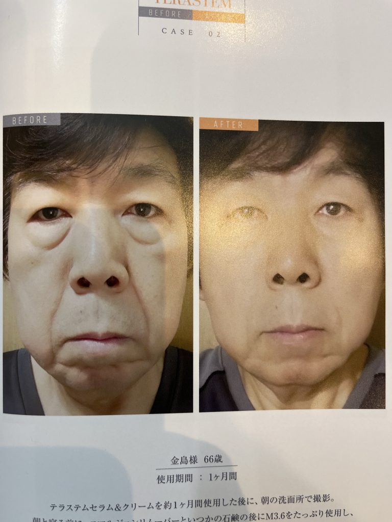 テラステムクリーム入荷しました。 | 徳島県板野郡藍住町の美容室 blmhair