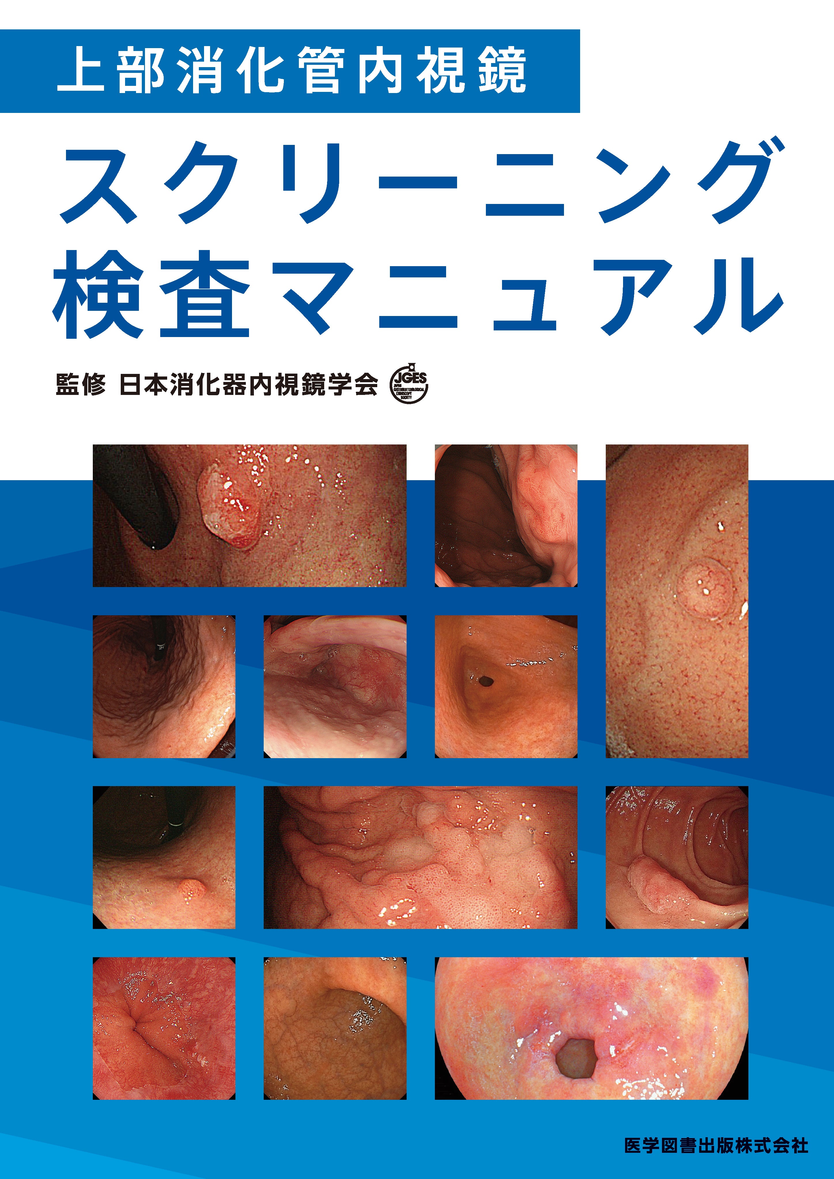 上部消化管内視鏡スクリーニング検査マニュアル – 医学図書出版