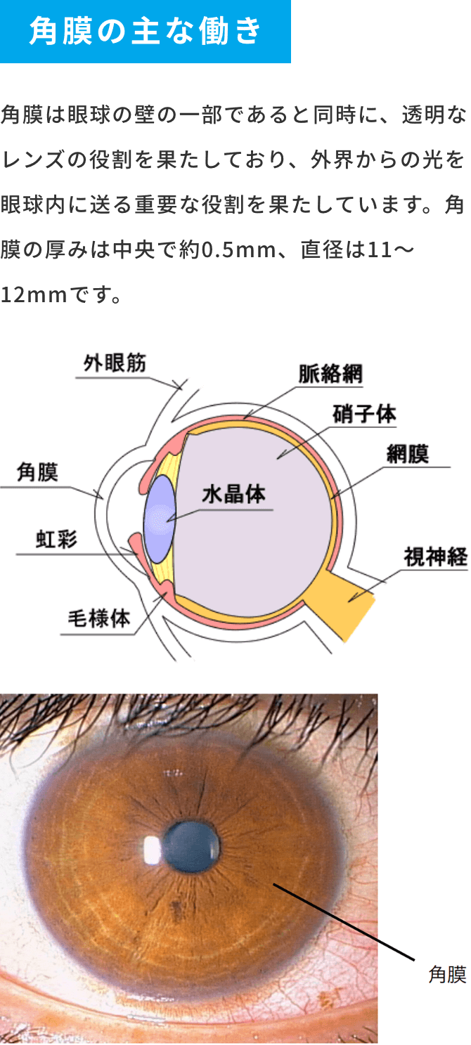 角膜疾患について | いがらし眼科クリニック