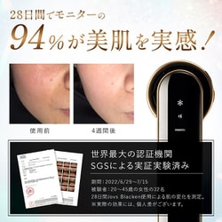 ヨドバシ.com - ジョブズ JOVS 家庭用光美顔器 JOVS Blacken