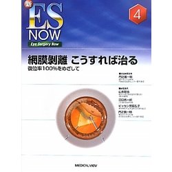 ヨドバシ.com - 網膜剥離こうすれば治る―復位率100%をめざして(新ES