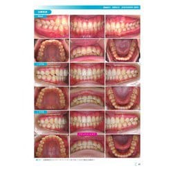 ヨドバシ.com - GPがアライナー矯正を行うときに外せないポイントを