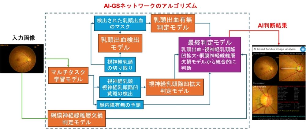 眼科専門医レベルの緑内障診断AIを開発：医療技術ニュース - MONOist