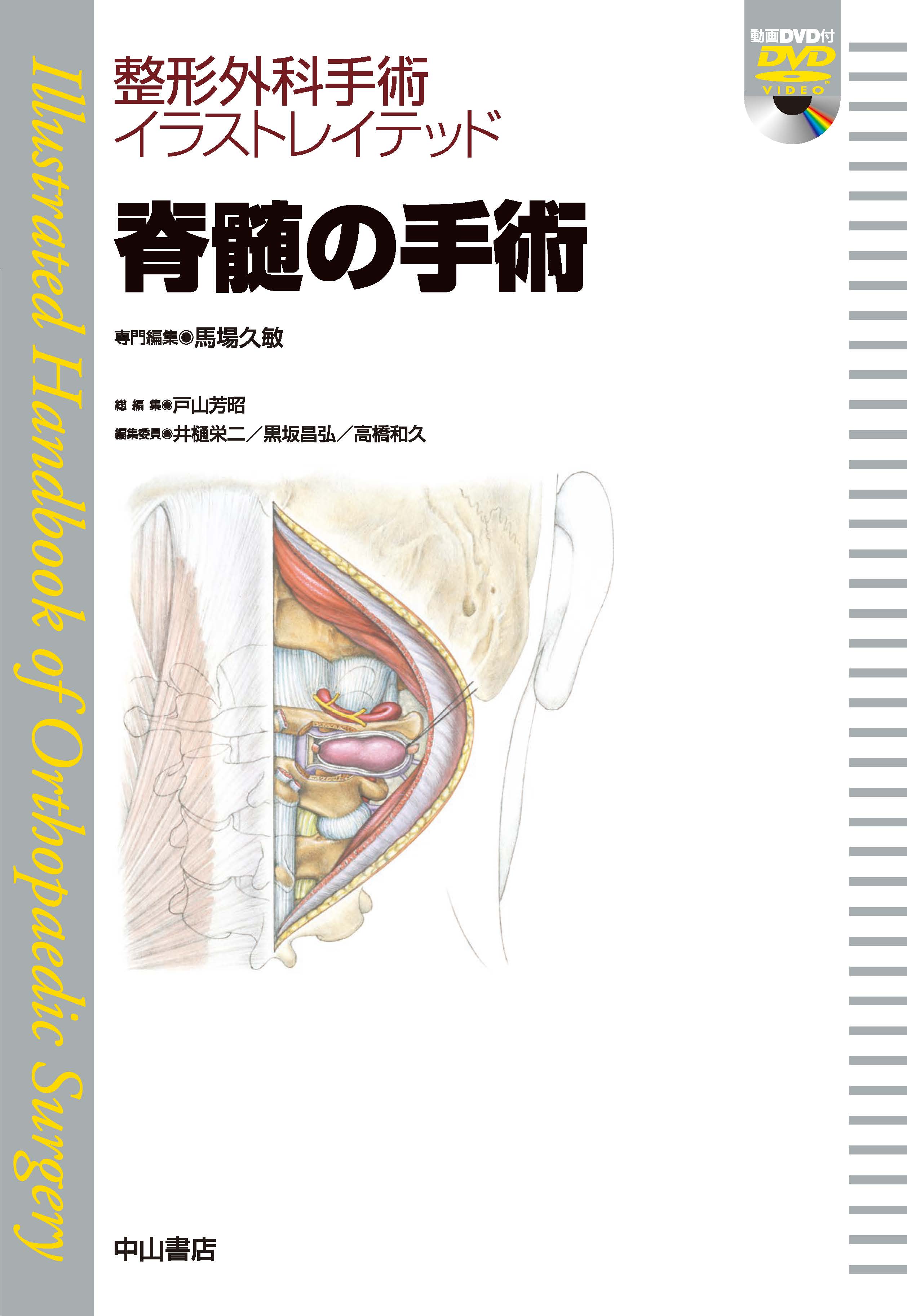整形外科手術イラストレイテッド 脊髄の手術 | 神陵文庫